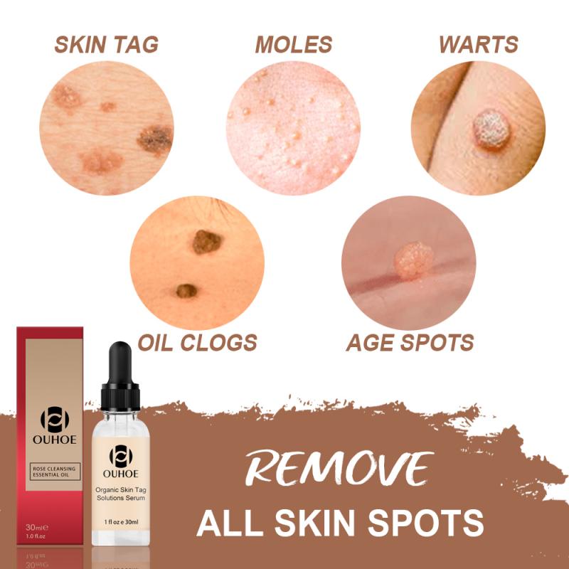 Organic Skin Spot Solutions Serum