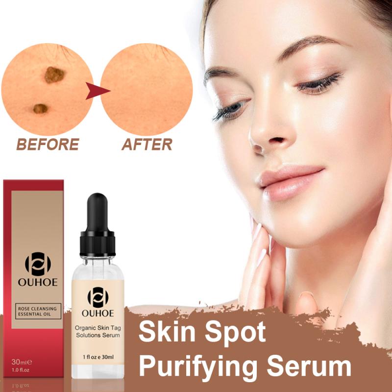 Organic Skin Spot Solutions Serum