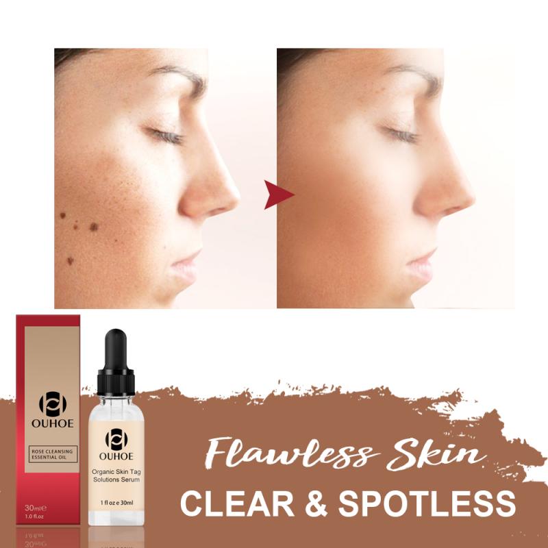 Organic Skin Spot Solutions Serum