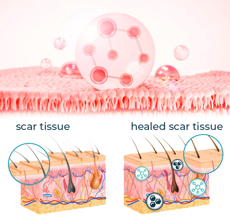 Bioskin™ Advanced Scar Removal Gel